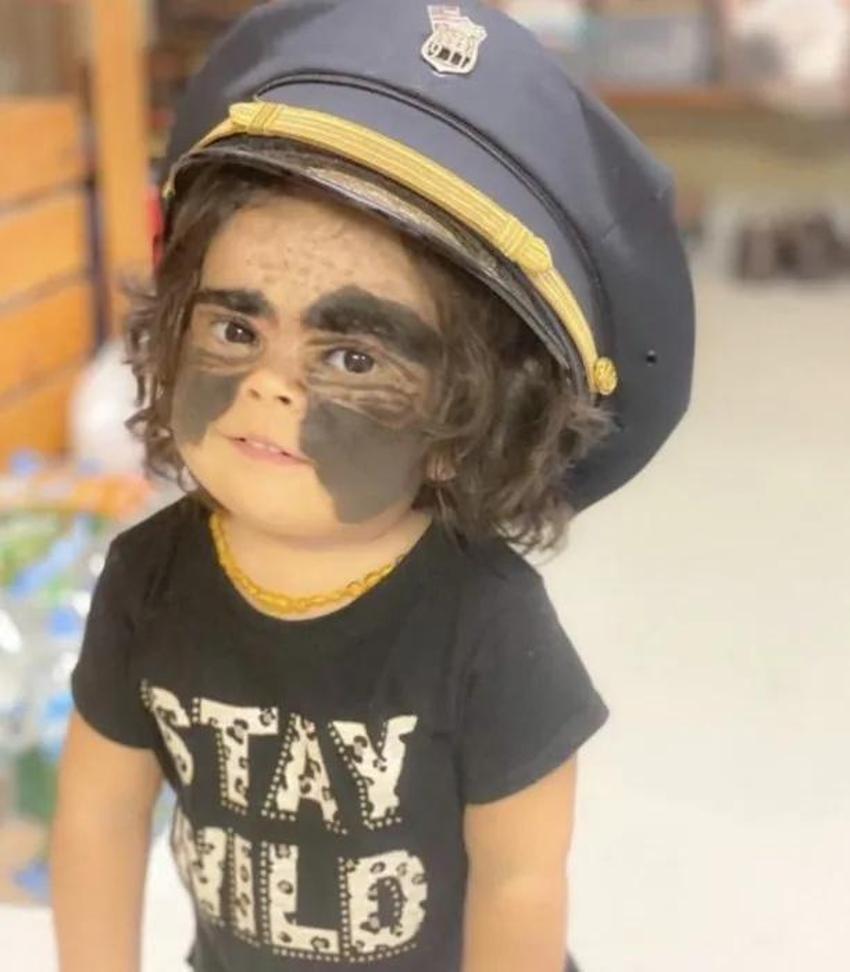 Yüzündeki leke yüzünden lanetli deniyordu! Küçük kızın şimdiki haline bir bakın!