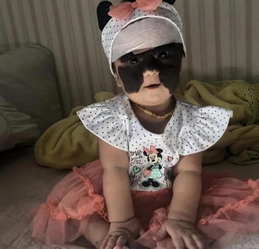 Yüzündeki leke yüzünden lanetli deniyordu! Küçük kızın şimdiki haline bir bakın!