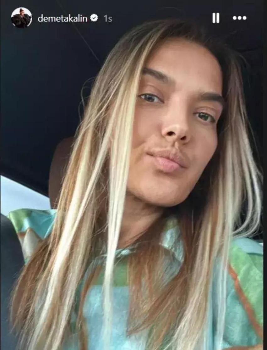 Demet Akalın önce 10 kilo verdi sonra imaj değiştirdi