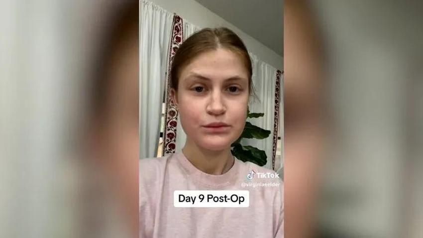 Bir çene ameliyatı bu kadar mı değiştirir! Genç kadının eski ve yeni halinde dağlar kadar fark var