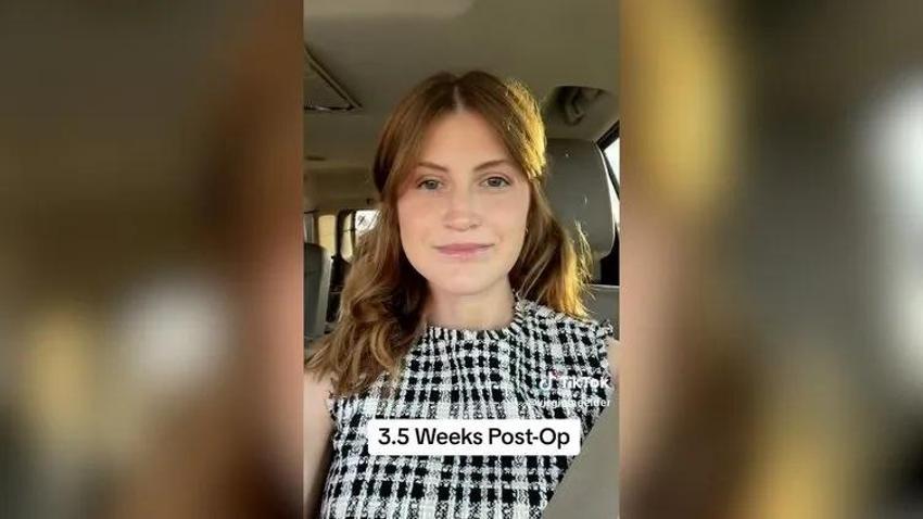 Bir çene ameliyatı bu kadar mı değiştirir! Genç kadının eski ve yeni halinde dağlar kadar fark var