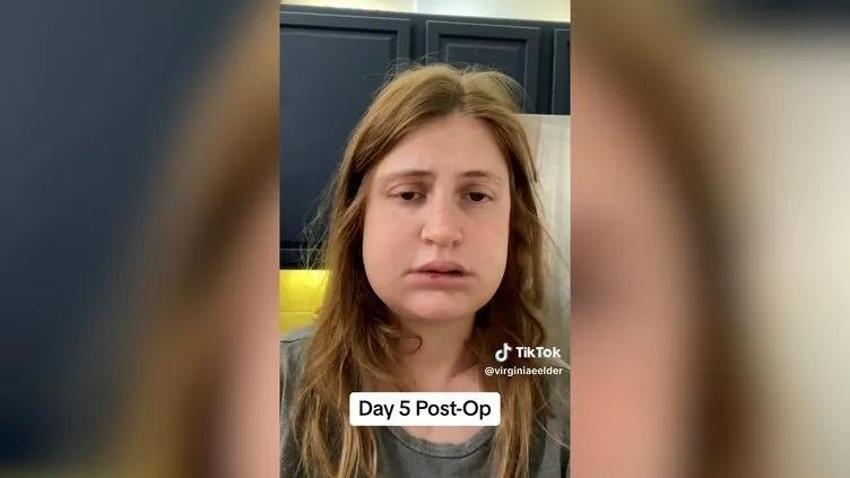 Bir çene ameliyatı bu kadar mı değiştirir! Genç kadının eski ve yeni halinde dağlar kadar fark var