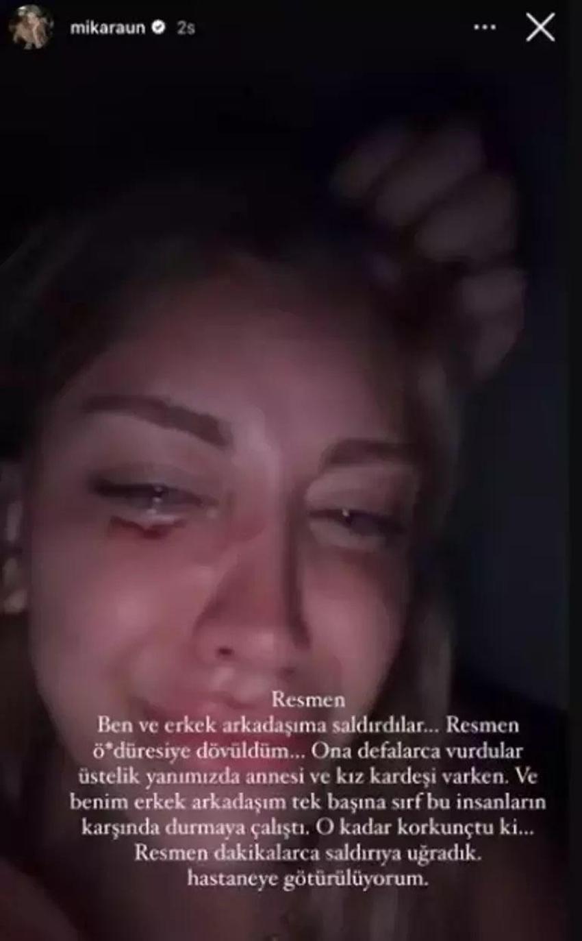 Fenomen Mika Can Raun saldırıya uğradı! 'Öldüresiye dövüldüm'