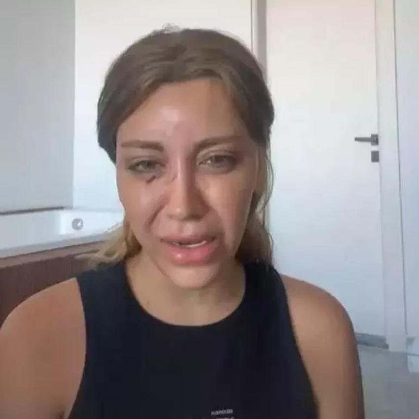 Fenomen Mika Can Raun saldırıya uğradı! 'Öldüresiye dövüldüm'