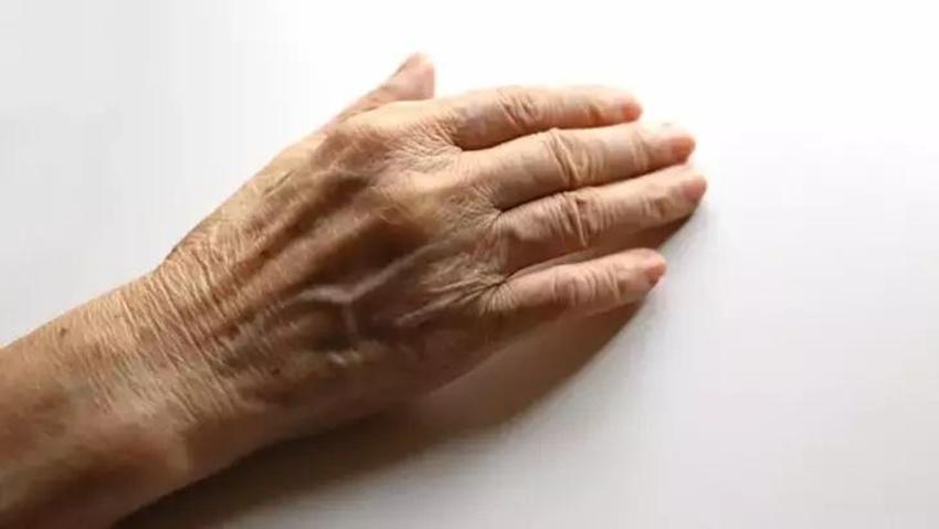 Ev yapımı nemlendirici: Bu yağ ellerde kuruluğu pamuk gibi yapıyor!