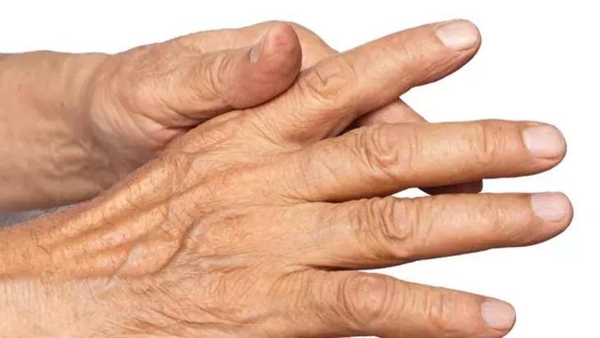 Ev yapımı nemlendirici: Bu yağ ellerde kuruluğu pamuk gibi yapıyor!