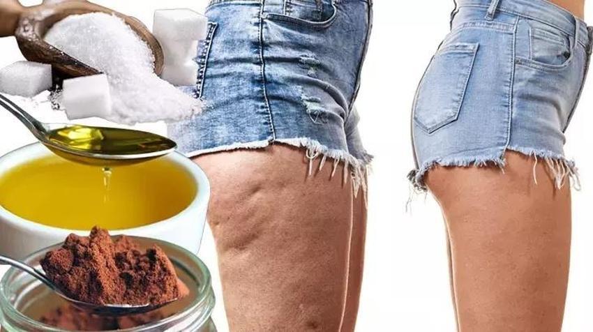 Selülit düşmannı, kaymak gibi cildin sırrı! Kahve, şeker ve zeytinyağı kurtarıyor