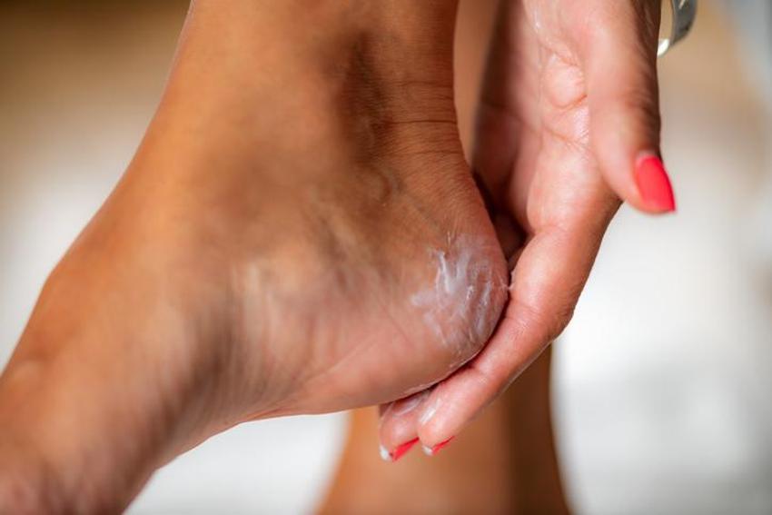 Topuk çatlaklarını ve kötü kokuyu gideren ekşi maya yöntemi