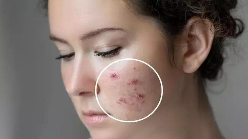 TikTok'ta bu kez klozet kapağı viral oldu! Bu video milyonlarca kez izlendi