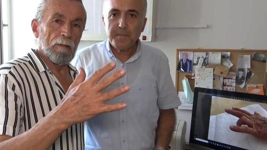 Adana'da 'Tetik parmak sendromu'nu iyileştiren bitkisel karışım geliştirdi! 12 farklı hastada iyileşme sağladı