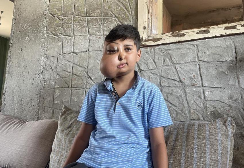 Hastalığı nedeniyle yüzünde kitle olan Enes'in sesi duyuldu: Ankara'da tedavisi başladı