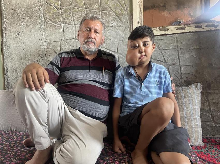 Hastalığı nedeniyle yüzünde kitle olan Enes'in sesi duyuldu: Ankara'da tedavisi başladı