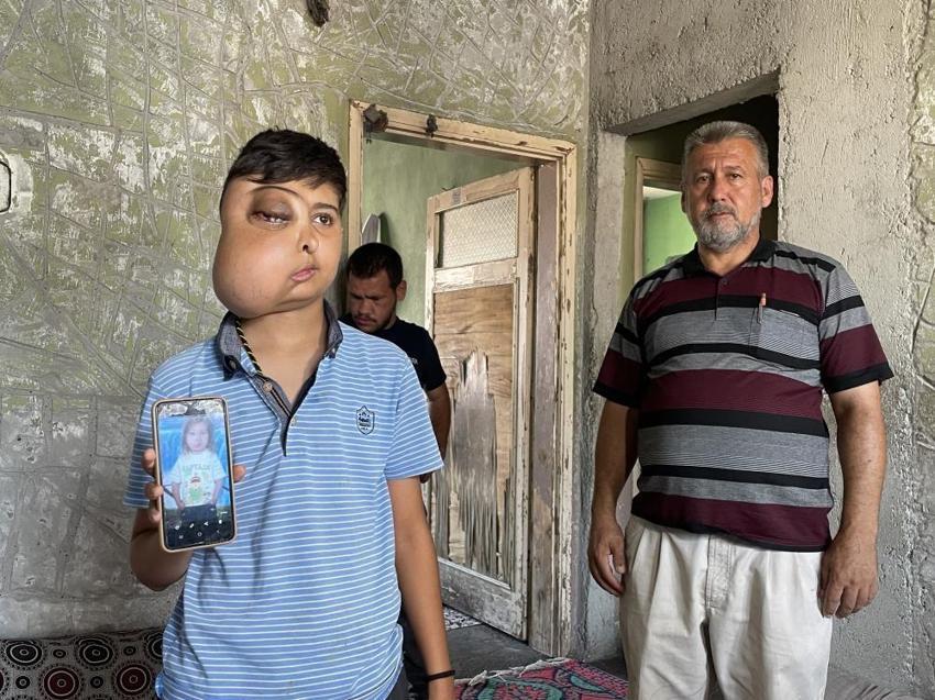 Hastalığı nedeniyle yüzünde kitle olan Enes'in sesi duyuldu: Ankara'da tedavisi başladı