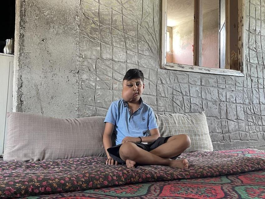 Hastalığı nedeniyle yüzünde kitle olan Enes'in sesi duyuldu: Ankara'da tedavisi başladı