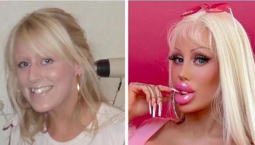 Barbie bebek olmak için 21 yaşında bunu yaptı! 6,5 milyon TL harcadı, değişimi dehşete düşürdü