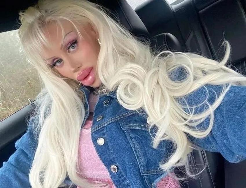 Barbie bebek olmak için 21 yaşında bunu yaptı! 6,5 milyon TL harcadı, değişimi dehşete düşürdü