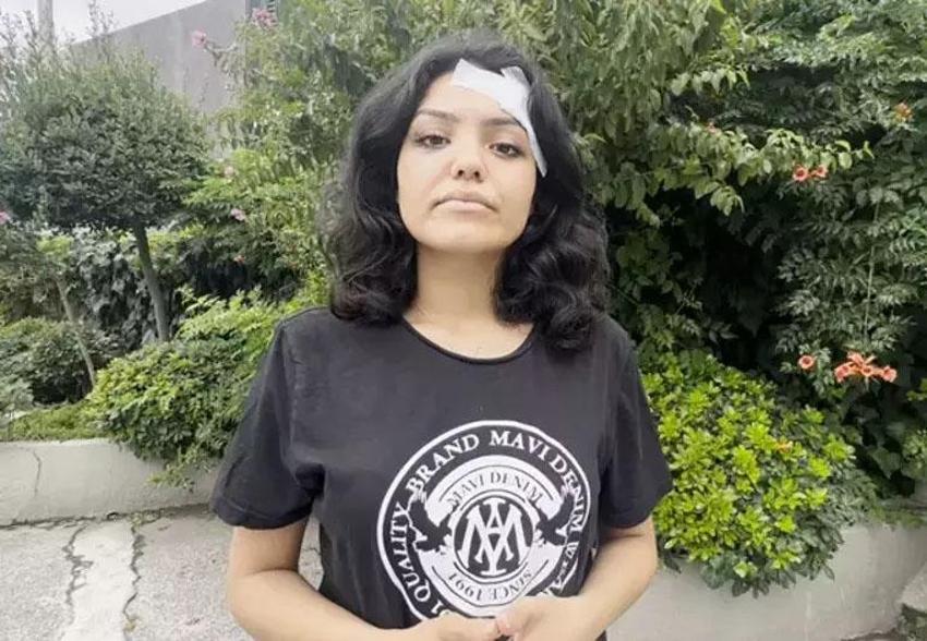 Topuklu ayakkabıyla başına vurulmuştu! Eslem Sena Nur yaşadıklarını anlattı