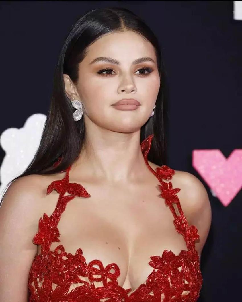 Yüzündeki değişim çok konuşulmuştu! Selena Gomez estetik iddialarına yanıt verdi