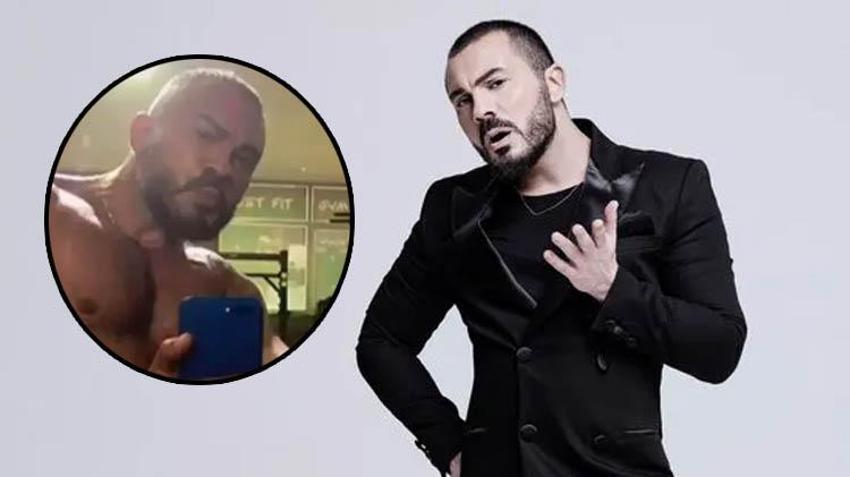 Değişimi şaşırtmıştı! Rober Hatemo yüzüne yaptırdığı işlemi açıkladı