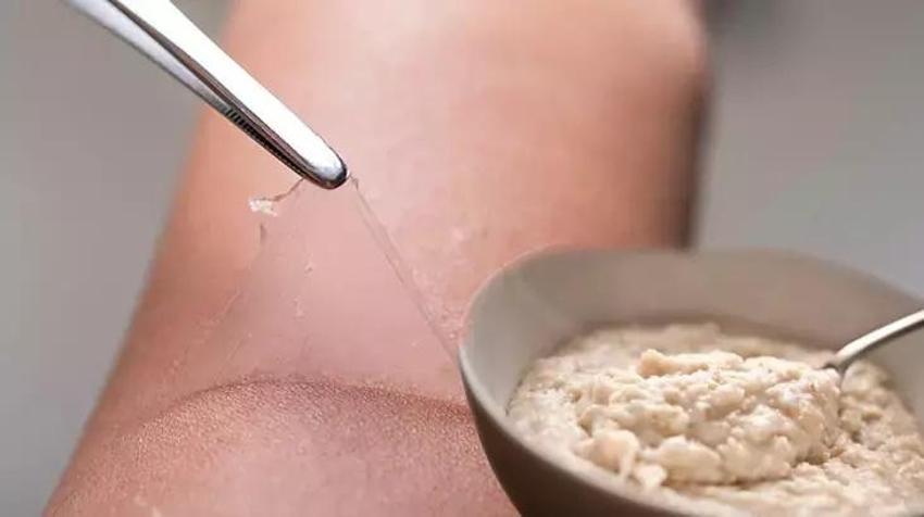 Cilt soyulmasına karşı görünmez kalkan oluyor! Bu merhemi mutfakta hazırlayınca güneş yanığı anında diniyor!
