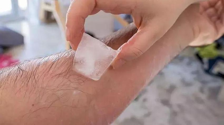 Cilt soyulmasına karşı görünmez kalkan oluyor! Bu merhemi mutfakta hazırlayınca güneş yanığı anında diniyor!
