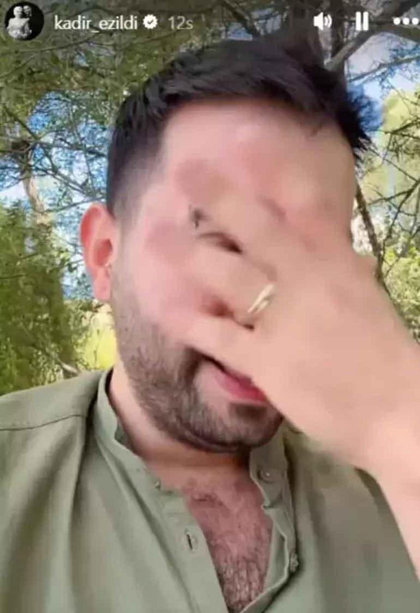 Kadir Ezildi'nin nişanlısına sürpriz yaptı, aldığı tepki şaşırttı!