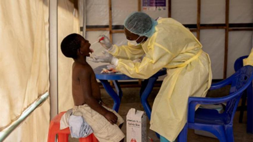 Maymun çiçeği korkusu tüm dünyayı sardı!  Mpox belirtileri neler? 'Maymun Çiçeği'nin anatomisi