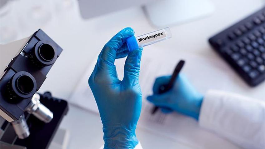Maymun çiçeği korkusu tüm dünyayı sardı!  Mpox belirtileri neler? 'Maymun Çiçeği'nin anatomisi