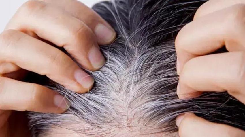 Can sıkıcı beyaz teller için 2 su bardağına 1 tatlı kaşığı yetiyor!