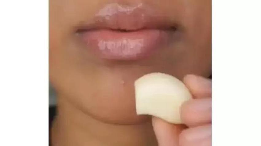 TikTok'ta yayıldı kimse durduramıyor! Çiğ sarımsak sivilceye iyi gelir mi?
