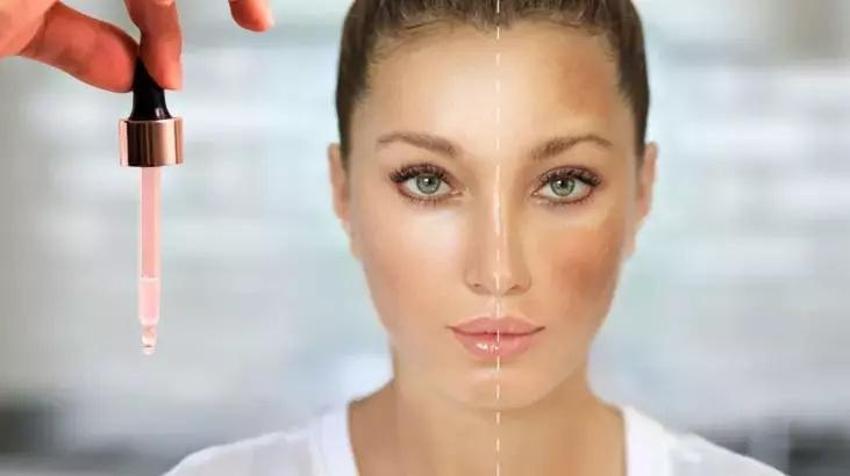 Cilt lekelerinin nedeni de çözümü buymuş! C vitamini sırrı ayna gibi parlatıyor