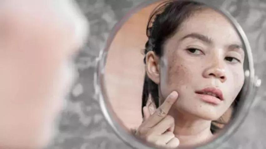 Cilt lekelerinin nedeni de çözümü buymuş! C vitamini sırrı ayna gibi parlatıyor