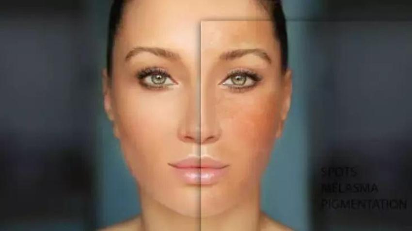 Cilt lekelerinin nedeni de çözümü buymuş! C vitamini sırrı ayna gibi parlatıyor