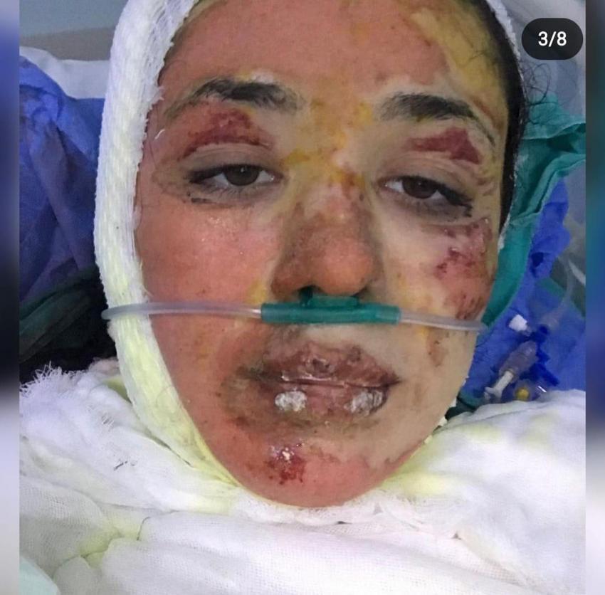 Gizem hemşireyi çakmakla yakmıştı: Abi yapma dedim, dinlemedi, ünlü yarışmaya katılıp herkesi ağlatmıştı