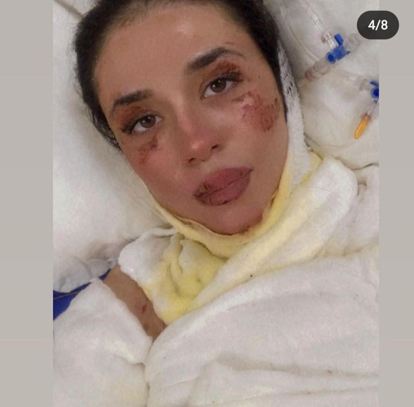 Gizem hemşireyi çakmakla yakmıştı: Abi yapma dedim, dinlemedi, ünlü yarışmaya katılıp herkesi ağlatmıştı