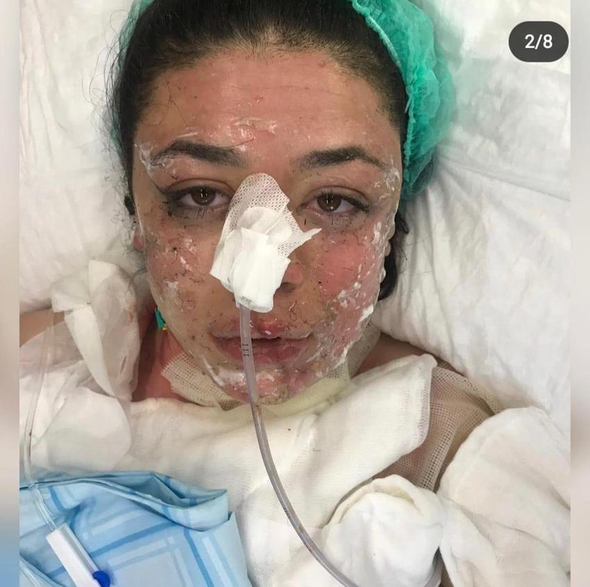 Gizem hemşireyi çakmakla yakmıştı: Abi yapma dedim, dinlemedi, ünlü yarışmaya katılıp herkesi ağlatmıştı
