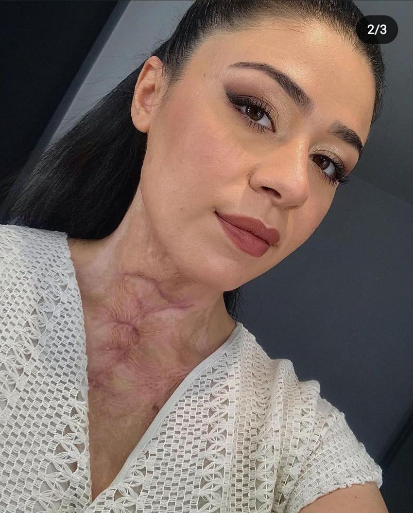 Gizem hemşireyi çakmakla yakmıştı: Abi yapma dedim, dinlemedi, ünlü yarışmaya katılıp herkesi ağlatmıştı