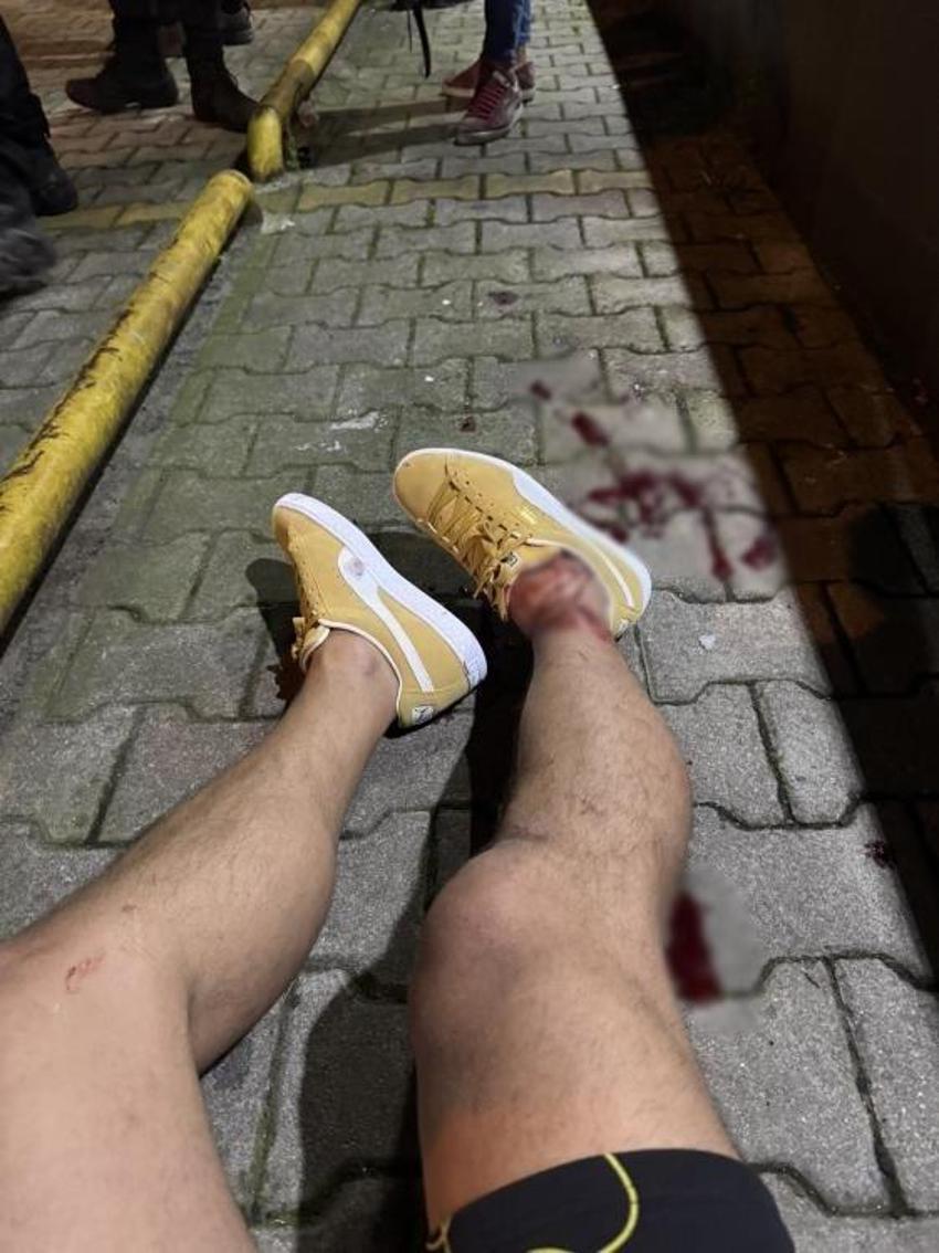 Serhat Akın’a silahlı saldırı! Vurulma anı ortaya çıktı: Program çıkışı ayaklarıma sıktılar son sözümüz...