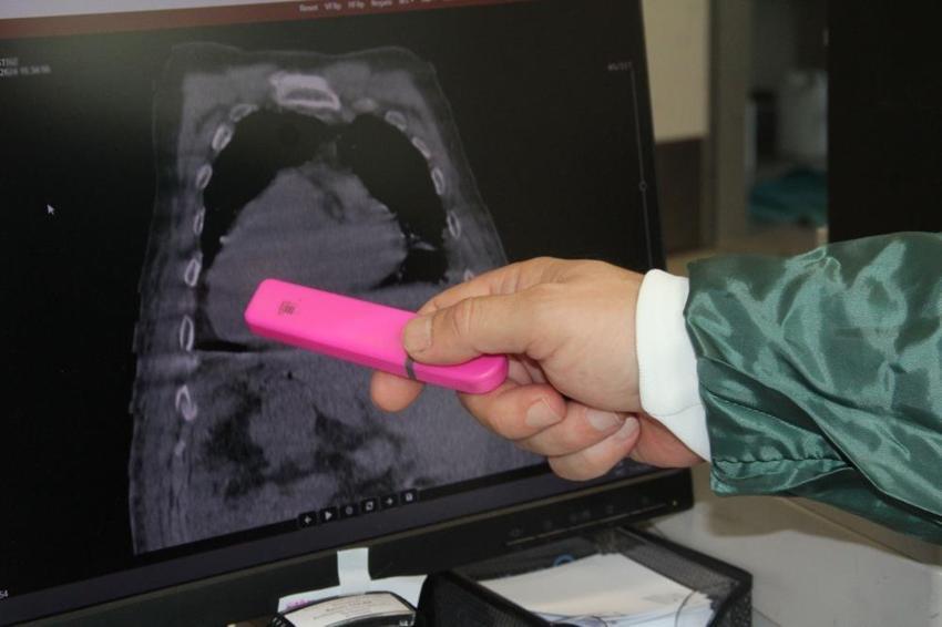Dünyada bir ilk: Doktorlar o hastalığa Giresun Sendromu ismini verdi!