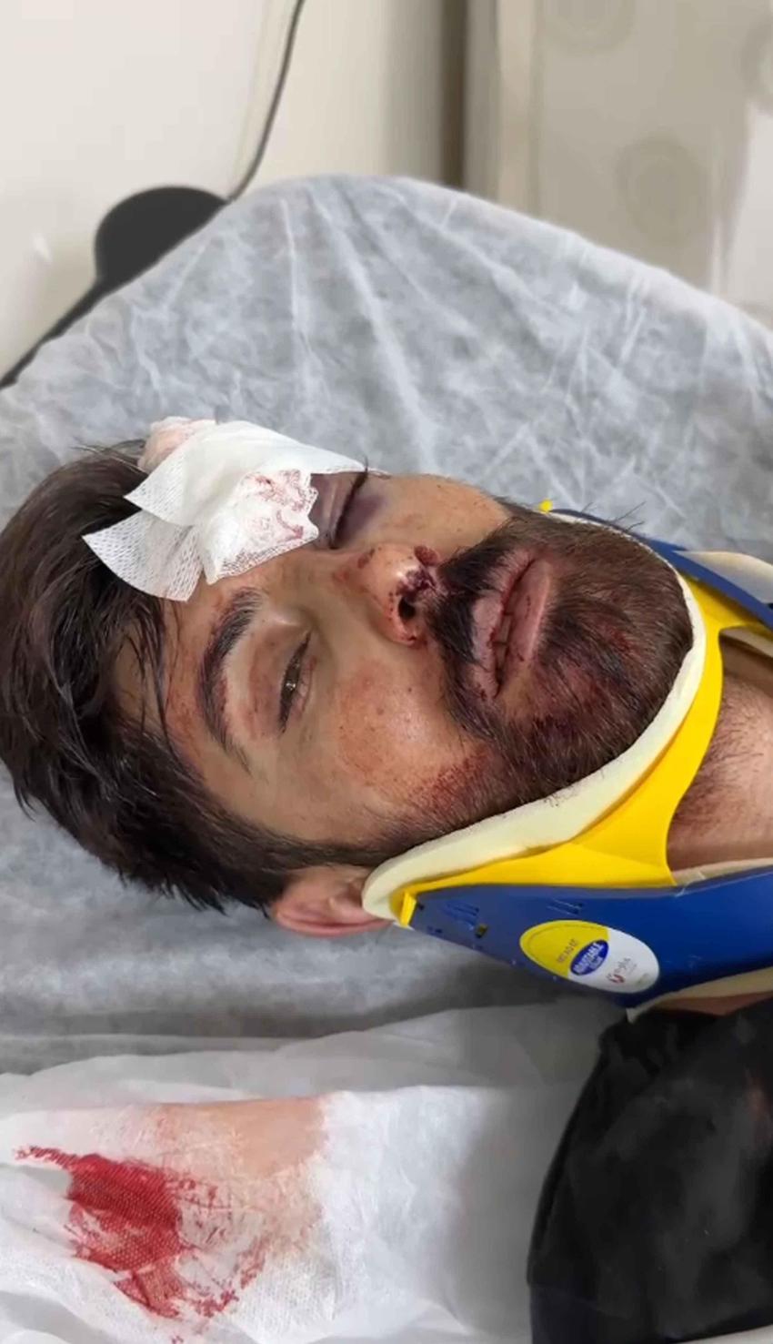 Antalya'da çiçekçi dehşeti! Eşinin fotoğraflarını paylaşan arkadaşını tek yumrukla komaya soktu