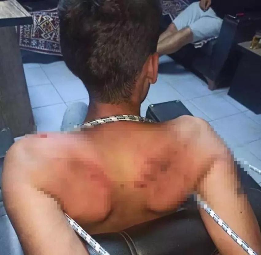 Çalıştığı iş yerinde günlerce alıkonuldu, işkence edilip böcek yedirildi
