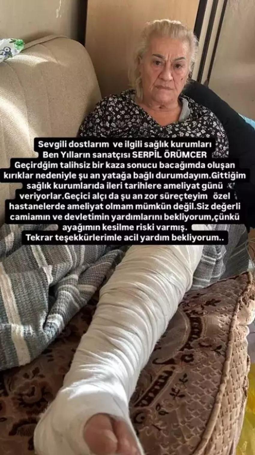 'Bayan Bacak' lakaplı Serpil Örümcer'den kötü haber! Yardım istedi: Ayağımın kesilme ihtimali varmış...
