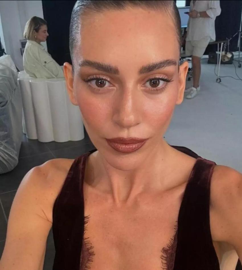 Sinem Kobal'ın yüzündeki değişim dikkat çekti!
