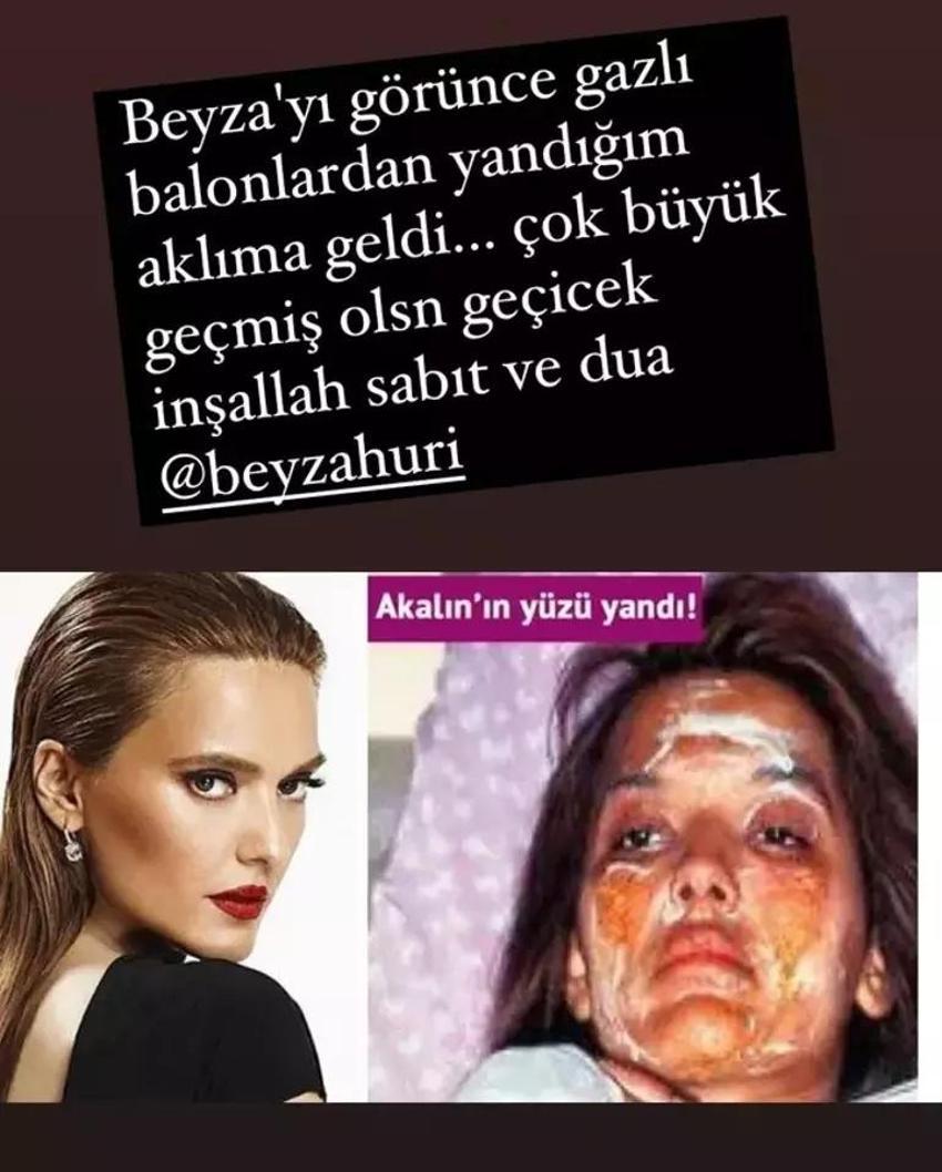 MasterChef'te talihsizlik! Beyza'nın yüzüne kızgın yağ döküldü