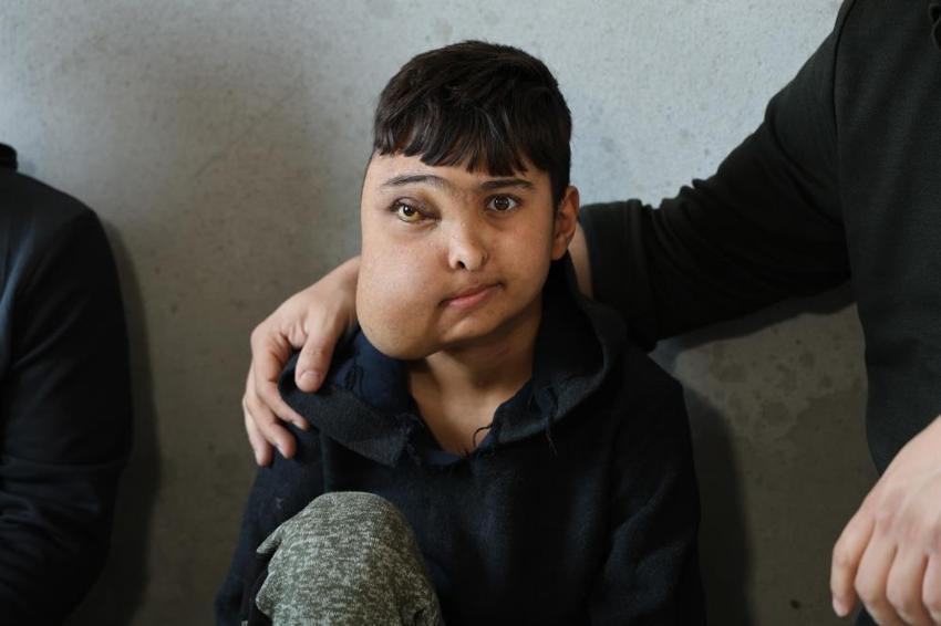 Yüzünde oluşan kitle nedeniyle okula gitmeyen Enes, sağlığına kavuşacak