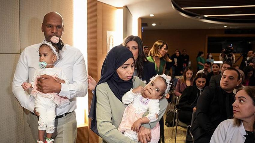 Cezayirli yapışık ikizler İstanbul'da ameliyatla ayrıldı