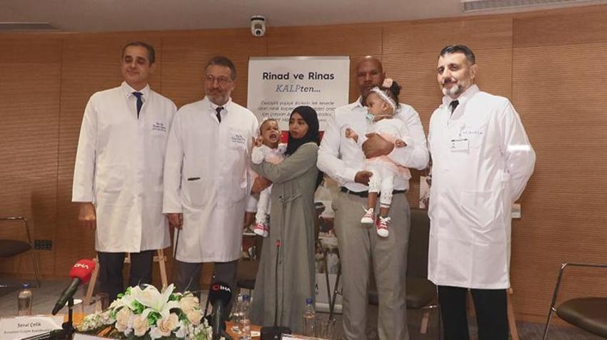 Cezayirli yapışık ikizler İstanbul'da ameliyatla ayrıldı