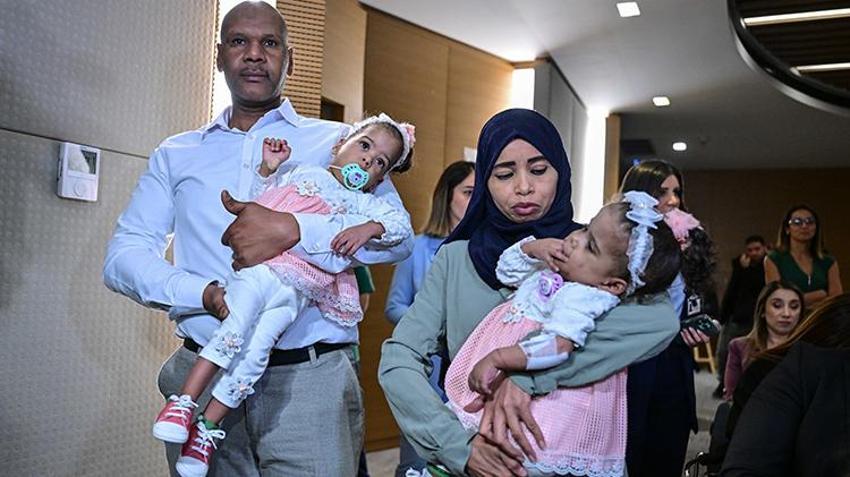 Cezayirli yapışık ikizler İstanbul'da ameliyatla ayrıldı