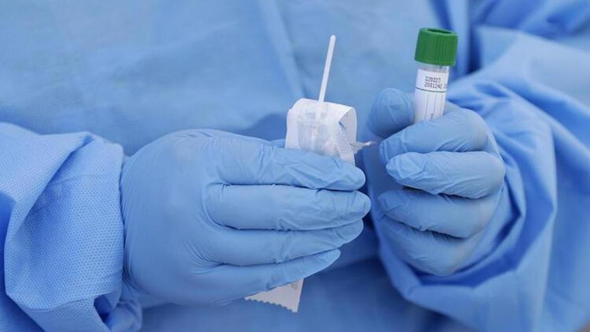 AIDS'li çocuk alarmı! 13 yaşında öldü, yeni tehlikeyi açıkladı, vakalarda büyük artış
