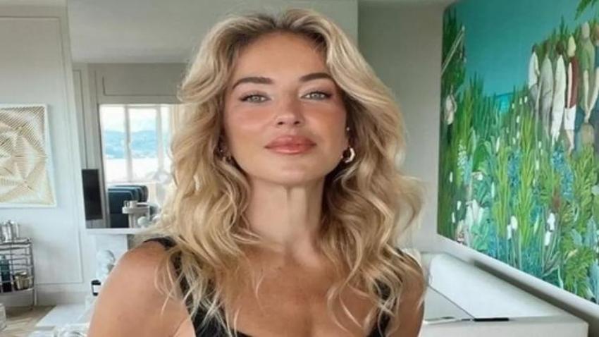 Burcu Esmersoy'dan estetik iddialarına yanıt!
